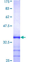 RAB3B Protein - 12.5% SDS-PAGE Stained with Coomassie Blue.