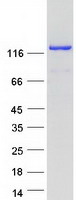 RAB3GAP1 Protein - Purified recombinant protein RAB3GAP1 was analyzed by SDS-PAGE gel and Coomassie Blue Staining