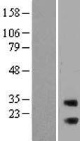 RAB3IP / RABIN3 Protein - Western validation with an anti-DDK antibody * L: Control HEK293 lysate R: Over-expression lysate