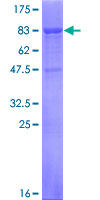 RAB3IP / RABIN3 Protein - 12.5% SDS-PAGE of human RAB3IP stained with Coomassie Blue