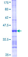 RAB3IP / RABIN3 Protein - 12.5% SDS-PAGE Stained with Coomassie Blue.