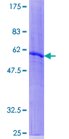 RAB40A / RAR2 Protein - 12.5% SDS-PAGE of human RAB40A stained with Coomassie Blue