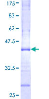RAB40A / RAR2 Protein - 12.5% SDS-PAGE Stained with Coomassie Blue.