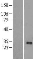 RAB40B Protein - Western validation with an anti-DDK antibody * L: Control HEK293 lysate R: Over-expression lysate