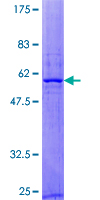 RAB40B Protein - 12.5% SDS-PAGE of human RAB40B stained with Coomassie Blue