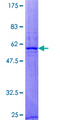 RAB40B Protein - 12.5% SDS-PAGE of human RAB40B stained with Coomassie Blue