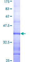 RAB40B Protein - 12.5% SDS-PAGE Stained with Coomassie Blue.