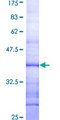 RAB40B Protein - 12.5% SDS-PAGE Stained with Coomassie Blue.