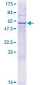 RAB40C Protein - 12.5% SDS-PAGE of human RAB40C stained with Coomassie Blue