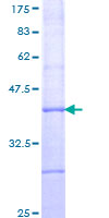RAB40C Protein - 12.5% SDS-PAGE Stained with Coomassie Blue.