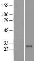 RAB41 Protein - Western validation with an anti-DDK antibody * L: Control HEK293 lysate R: Over-expression lysate