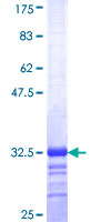RAB42 Protein - 12.5% SDS-PAGE Stained with Coomassie Blue.