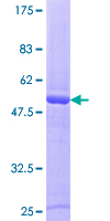 RAB43 Protein - 12.5% SDS-PAGE of human RAB43 stained with Coomassie Blue