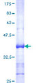 RAB43 Protein - 12.5% SDS-PAGE Stained with Coomassie Blue.
