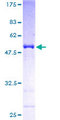 RAB4A / RAB4 Protein - 12.5% SDS-PAGE of human RAB4A stained with Coomassie Blue