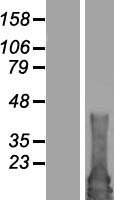 RAB4B Protein - Western validation with an anti-DDK antibody * L: Control HEK293 lysate R: Over-expression lysate