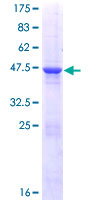 RAB4B Protein - 12.5% SDS-PAGE of human RAB4B stained with Coomassie Blue