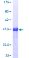 RAB5A / RAB5 Protein - 12.5% SDS-PAGE of human RAB5A stained with Coomassie Blue