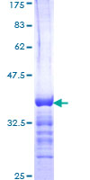 RAB5A / RAB5 Protein - 12.5% SDS-PAGE Stained with Coomassie Blue.