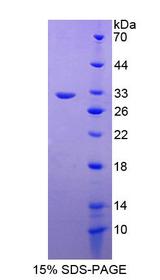 RAB5A / RAB5 Protein - Recombinant RAB5A, Member RAS Oncogene Family By SDS-PAGE