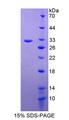 RAB5A / RAB5 Protein - Recombinant RAB5A, Member RAS Oncogene Family By SDS-PAGE
