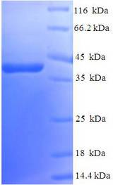 RAB5A / RAB5 Protein