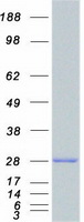 RAB5A / RAB5 Protein - Purified recombinant protein RAB5A was analyzed by SDS-PAGE gel and Coomassie Blue Staining