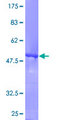 RAB5B Protein - 12.5% SDS-PAGE of human RAB5B stained with Coomassie Blue