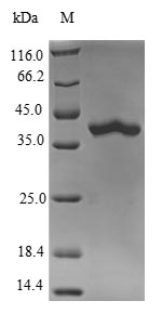 RAB5B Protein - (Tris-Glycine gel) Discontinuous SDS-PAGE (reduced) with 5% enrichment gel and 15% separation gel.