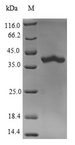 RAB5B Protein - (Tris-Glycine gel) Discontinuous SDS-PAGE (reduced) with 5% enrichment gel and 15% separation gel.