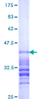 RAB5B Protein - 12.5% SDS-PAGE Stained with Coomassie Blue.