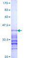 RAB5B Protein - 12.5% SDS-PAGE Stained with Coomassie Blue.
