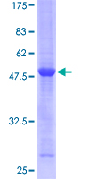 RAB5C Protein - 12.5% SDS-PAGE of human RAB5C stained with Coomassie Blue