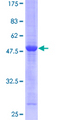 RAB5C Protein - 12.5% SDS-PAGE of human RAB5C stained with Coomassie Blue