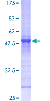 RAB6A / RAB6 Protein - 12.5% SDS-PAGE of human RAB6A stained with Coomassie Blue