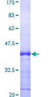 RAB6A / RAB6 Protein - 12.5% SDS-PAGE Stained with Coomassie Blue.