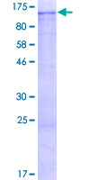 RAB6KIFL / KIF20A Protein - 12.5% SDS-PAGE of human KIF20A stained with Coomassie Blue