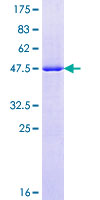 RAB7A / RAB7 Protein - 12.5% SDS-PAGE of human RAB7 stained with Coomassie Blue