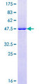 RAB7A / RAB7 Protein - 12.5% SDS-PAGE of human RAB7 stained with Coomassie Blue