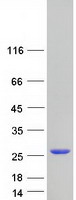 RAB7B Protein - Purified recombinant protein RAB7B was analyzed by SDS-PAGE gel and Coomassie Blue Staining