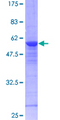 RAB8A / RAB8 Protein - 12.5% SDS-PAGE of human RAB8A stained with Coomassie Blue