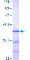 RAB8A / RAB8 Protein - 12.5% SDS-PAGE Stained with Coomassie Blue.