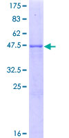 RAB8B Protein - 12.5% SDS-PAGE of human RAB8B stained with Coomassie Blue