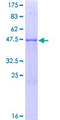 RAB8B Protein - 12.5% SDS-PAGE of human RAB8B stained with Coomassie Blue