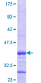 RAB8B Protein - 12.5% SDS-PAGE Stained with Coomassie Blue.