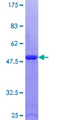 RAB9A / RAB9 Protein - 12.5% SDS-PAGE of human RAB9A stained with Coomassie Blue