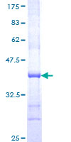 RAB9A / RAB9 Protein - 12.5% SDS-PAGE Stained with Coomassie Blue.