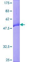 RAB9B Protein - 12.5% SDS-PAGE of human RAB9B stained with Coomassie Blue