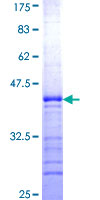RAB9B Protein - 12.5% SDS-PAGE Stained with Coomassie Blue.