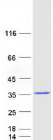 RAB9B Protein - Purified recombinant protein RAB9B was analyzed by SDS-PAGE gel and Coomassie Blue Staining